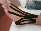 Kineziotaping